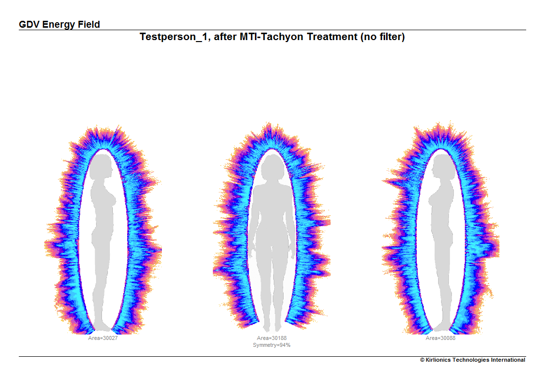 GDV Energy Field después de MTI-Tachyon — campo continuo, simetría 94%
